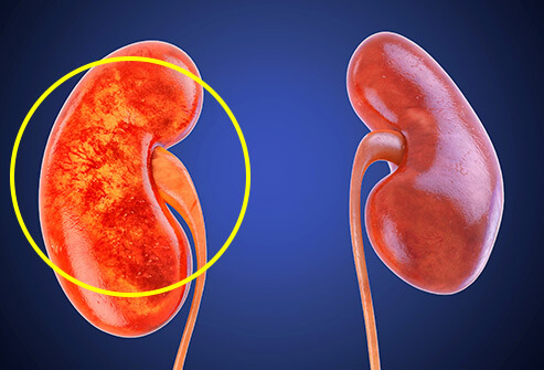 k_kidney k_kidney