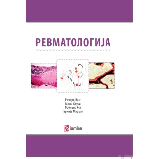 Ревматологија Медицина Kiwi.mk
